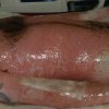 24 Year old male in early stage of Toxic Epidermal Necrolysis Syndrome with severe Ocular involvement. Approximately 4 days into reaction. (6)